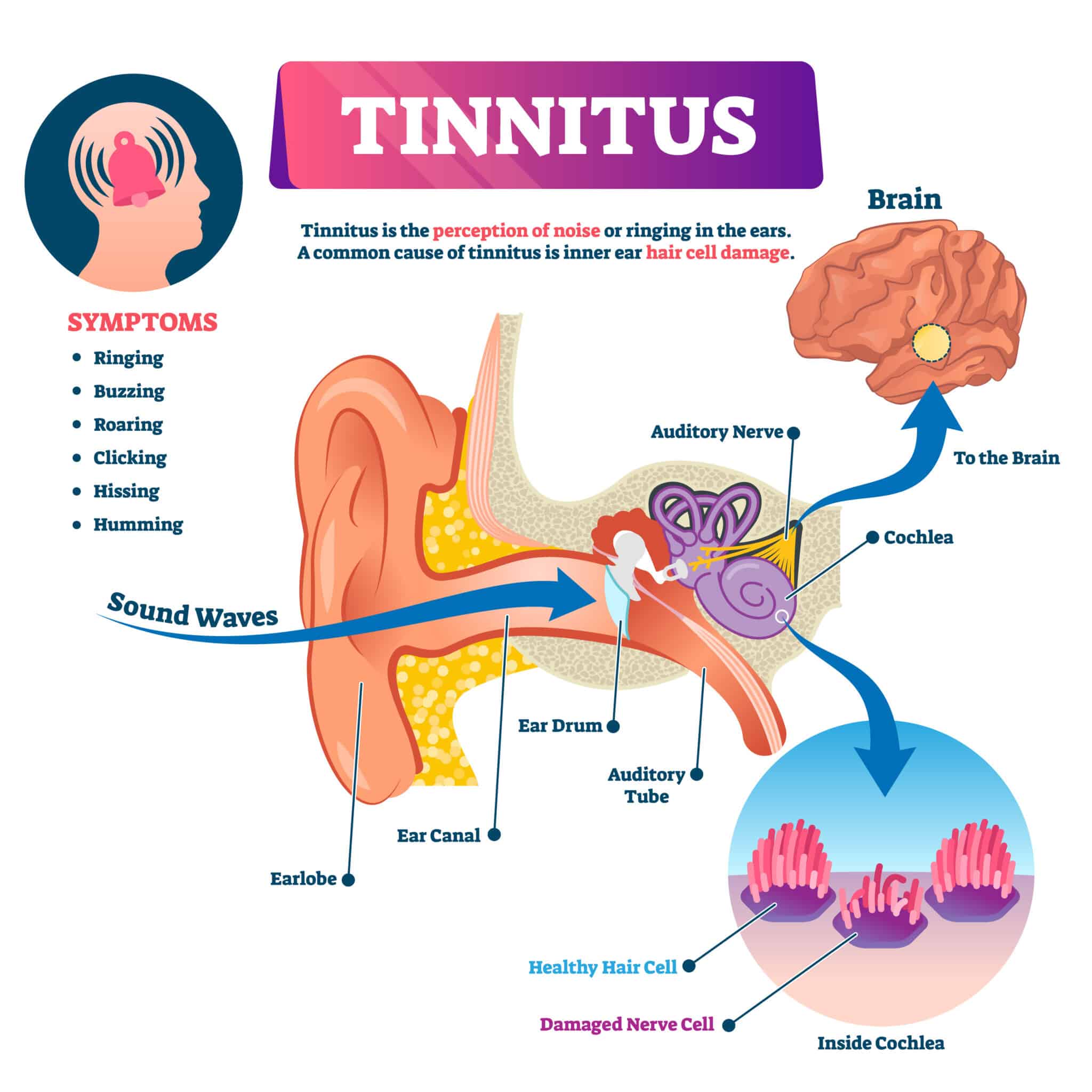 Tinnitus Talk All The Information You Need Lexie Hearing 